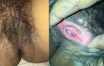 Cận Cảnh Lồn Nhiều Lông Mbbg Ngoài Thâm Trong Hồng Nhiều Nước